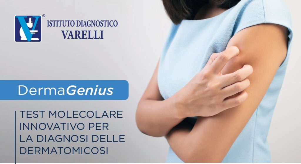 Derma Genius: test molecolare innovativo per la diagnosi delle dermatomicosi